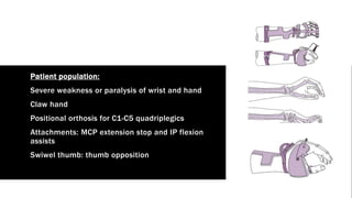 Safe Position Hand orthosis and prosthesis of upper limb | PPTX
