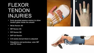 Pip Blocking orthosis and prosthesis of upper limb | PPTX