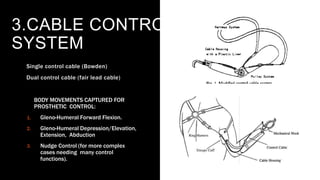 orthosis and prosthesis of upper limb | PPTX