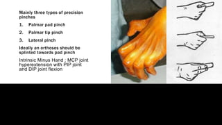 orthosis and prosthesis of upper limb | PPTX