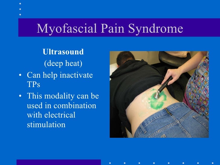 Myofascial Pain Syndrome