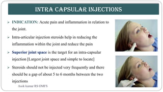 Myofascial pain dysfunction syndrome | PDF