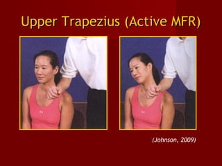 Upper Trapezius (Active MFR)Upper Trapezius (Active MFR)
(Johnson, 2009)
 