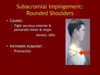 Subacromial Impingement:Subacromial Impingement:
Rounded ShouldersRounded Shoulders
• Causes:Causes:
- Tight serratus anterior &Tight serratus anterior &
pectoralis minor & majorpectoralis minor & major
(Kendall, 2005)(Kendall, 2005)
• Increases scapular:Increases scapular:
- ProtractionProtraction
 