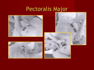 Pectoralis MajorPectoralis Major
 