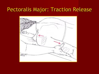 Pectoralis Major: Traction ReleasePectoralis Major: Traction Release
 