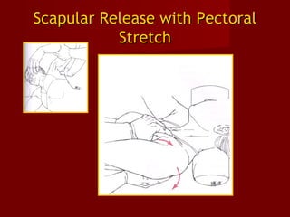 Scapular Release with PectoralScapular Release with Pectoral
StretchStretch
 