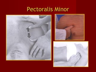 Pectoralis MinorPectoralis Minor
 