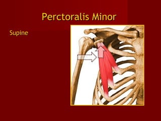 Perctoralis MinorPerctoralis Minor
SupineSupine
 