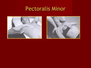 Pectoralis MinorPectoralis Minor
 