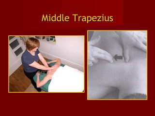 Middle TrapeziusMiddle Trapezius
 