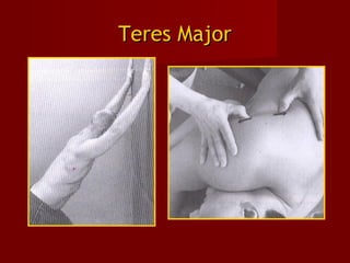 Teres MajorTeres Major
 