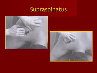 SupraspinatusSupraspinatus
 
