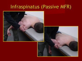 Infraspinatus (Passive MFR)Infraspinatus (Passive MFR)
 