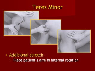 Teres MinorTeres Minor
• Additional stretchAdditional stretch
- Place patient’s arm in internal rotationPlace patient’s arm in internal rotation
 