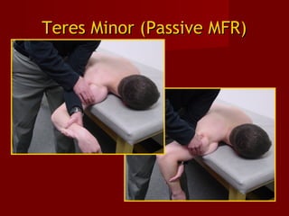 Teres Minor (Passive MFR)Teres Minor (Passive MFR)
 