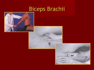 Biceps BrachiiBiceps Brachii
 