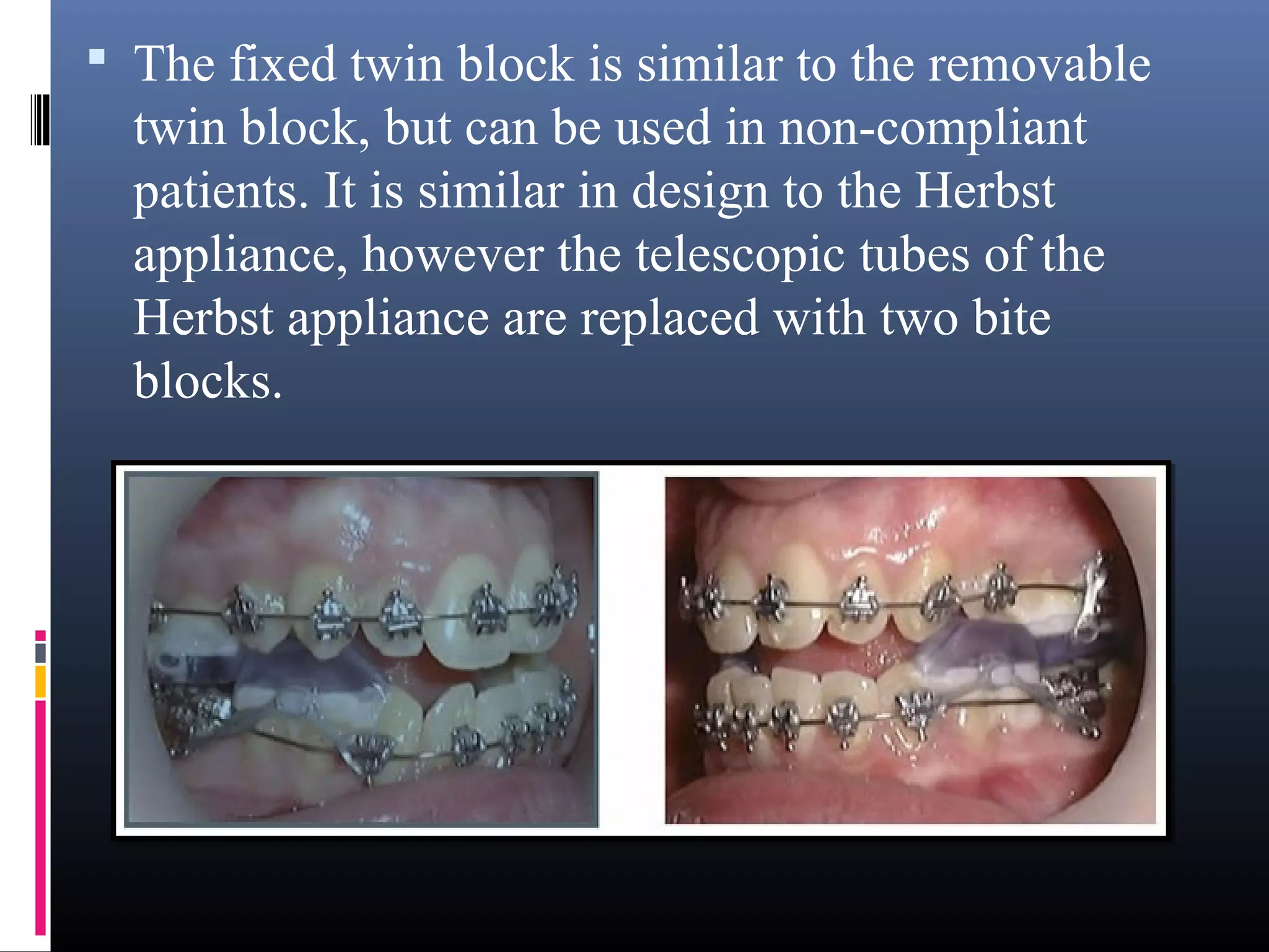 Myofunctional Appliances In Orthodontics PPT