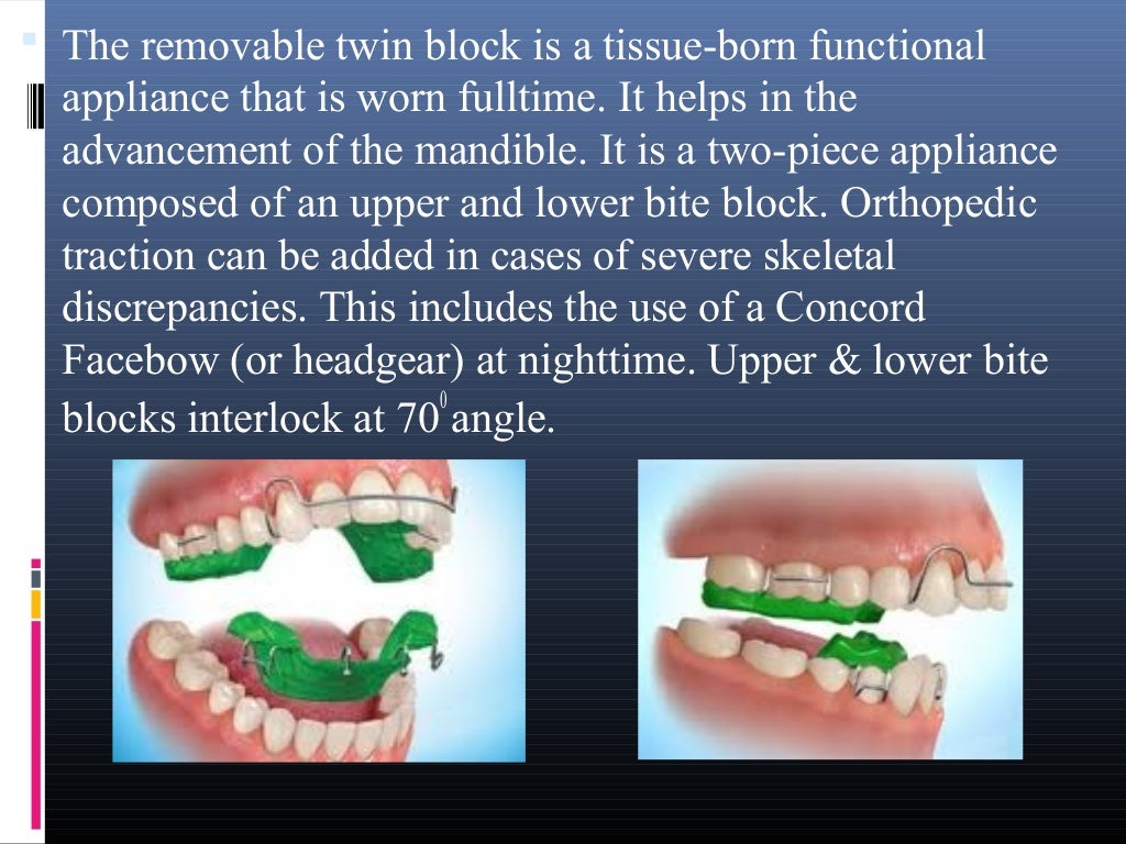 Myofunctional Appliances in orthodontics