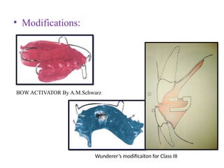 • Modifications:
BOW ACTIVATOR By A.M.Schwarz
Wunderer’s modificaiton for Class III
 