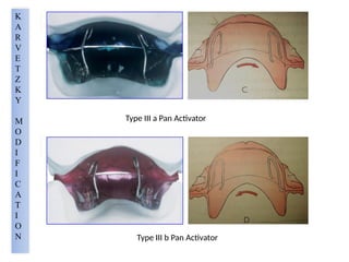 K
A
R
V
E
T
Z
K
Y
M
O
D
I
F
I
C
A
T
I
O
N
Type III a Pan Activator
Type III b Pan Activator
 