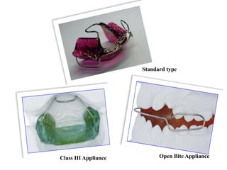 Standard type
Class III Appliance Open Bite Appliance
 