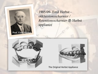 The Original Herbst Appliance
Prof. Emil Herbst
1905/09- Emil Herbst -
okklussionsscharnier /
Retentionsscharnier  Herbst
appliance
 