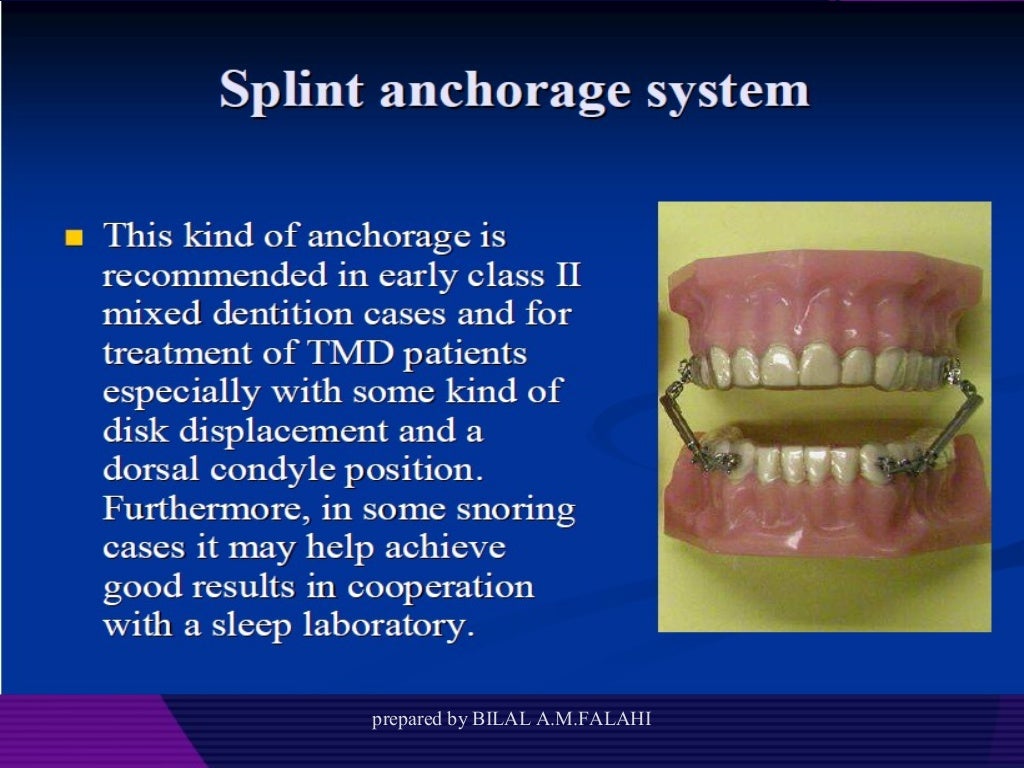 Myofunctional appliances in orthodontic
