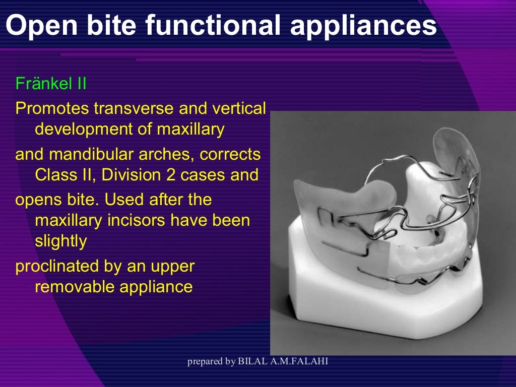 Myofunctional appliances in orthodontic