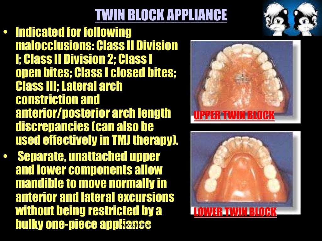 Myofunctional appliances activators /certified fixed orthodontic c…