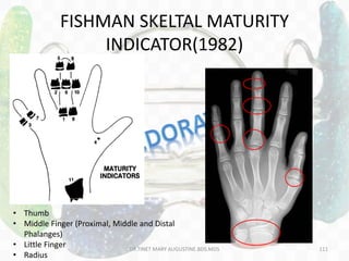 FISHMAN SKELTAL MATURITY
INDICATOR(1982)
• Thumb
• Middle Finger (Proximal, Middle and Distal
Phalanges)
• Little Finger
• Radius
DR.TINET MARY AUGUSTINE.BDS.MDS 111
 