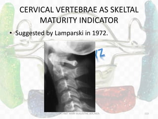 CERVICAL VERTEBRAE AS SKELTAL
MATURITY INDICATOR
• Suggested by Lamparski in 1972.
DR.TINET MARY AUGUSTINE.BDS.MDS 113
 