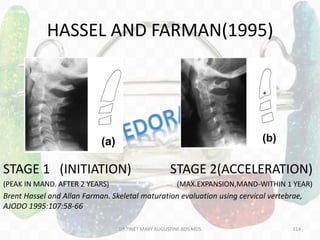 HASSEL AND FARMAN(1995)
STAGE 1 (INITIATION) STAGE 2(ACCELERATION)
(PEAK IN MAND. AFTER 2 YEARS) (MAX.EXPANSION,MAND-WITHIN 1 YEAR)
Brent Hassel and Allan Farman. Skeletal maturation evaluation using cervical vertebrae,
AJODO 1995:107:58-66
DR.TINET MARY AUGUSTINE.BDS.MDS 114
 