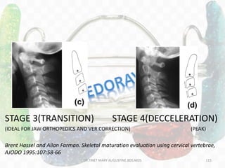 STAGE 3(TRANSITION) STAGE 4(DECCELERATION)
(IDEAL FOR JAW ORTHOPEDICS AND VER.CORRECTION) (PEAK)
Brent Hassel and Allan Farman. Skeletal maturation evaluation using cervical vertebrae,
AJODO 1995:107:58-66
DR.TINET MARY AUGUSTINE.BDS.MDS 115
 