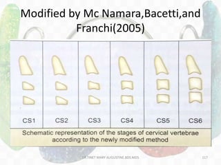 Modified by Mc Namara,Bacetti,and
Franchi(2005)
DR.TINET MARY AUGUSTINE.BDS.MDS 117
 