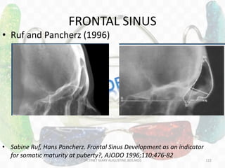 FRONTAL SINUS
• Ruf and Pancherz (1996)
• Sabine Ruf, Hans Pancherz. Frontal Sinus Development as an indicator
for somatic maturity at puberty?, AJODO 1996;110:476-82
DR.TINET MARY AUGUSTINE.BDS.MDS 122
 