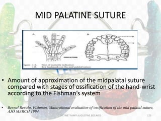 MID PALATINE SUTURE
• Amount of approximation of the midpalatal suture
compared with stages of ossification of the hand-wrist
according to the Fishman’s system
• Bernal Revalo, Fishman. Maturational evaluation of ossification of the mid palatal suture,
AJO MARCH 1994
DR.TINET MARY AUGUSTINE.BDS.MDS 125
 