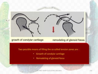 150
• McNamara & Petrovic noticed one peculiar phenomenon where patient
experienced pain when mandible was retracted.
PTERYGOID RESPONSE(petrovic 1980)
This was due to altered muscular balance resulting in ‘tension zone’ distal to
condyle.(harvold and wood side)Two possible means of filling the so called tension zones are :
• Growth of condylar cartilage
• Remodeling of glenoid fossa
DR.TINET MARY AUGUSTINE.BDS.MDS
 