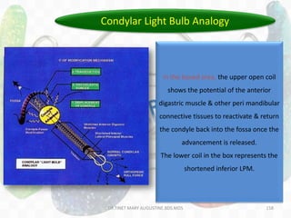 158
• Condyle acts as a light bulb on a
dimmer switch.
• When condylar growth is
continuously advanced, it lights up
like a bulb.
• When condyle is released from the
anterior displacement, the reactivated
muscle activity dims the light bulb &
returns it close to normal growth
activity.
In the boxed area, the upper open coil
shows the potential of the anterior
digastric muscle & other peri mandibular
connective tissues to reactivate & return
the condyle back into the fossa once the
advancement is released.
The lower coil in the box represents the
shortened inferior LPM.
Condylar Light Bulb Analogy
DR.TINET MARY AUGUSTINE.BDS.MDS
 
