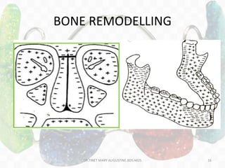 BONE REMODELLING
DR.TINET MARY AUGUSTINE.BDS.MDS 16
 
