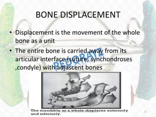 BONE DISPLACEMENT
• Displacement is the movement of the whole
bone as a unit
• The entire bone is carried away from its
articular interface (suture, synchondroses
,condyle) with adjascent bones
DR.TINET MARY AUGUSTINE.BDS.MDS 21
 