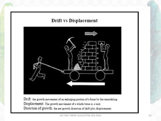 DR.TINET MARY AUGUSTINE.BDS.MDS 24
 