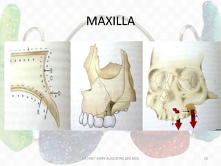 MAXILLA
DR.TINET MARY AUGUSTINE.BDS.MDS 26
 