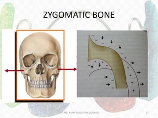 ZYGOMATIC BONE
DR.TINET MARY AUGUSTINE.BDS.MDS 27
 