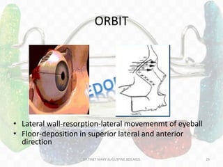 ORBIT
• Lateral wall-resorption-lateral movemenmt of eyeball
• Floor-deposition in superior lateral and anterior
direction
DR.TINET MARY AUGUSTINE.BDS.MDS 29
 