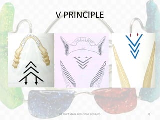 V PRINCIPLE
DR.TINET MARY AUGUSTINE.BDS.MDS 32
 