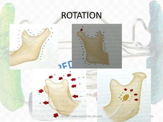 ROTATION
DR.TINET MARY AUGUSTINE.BDS.MDS 34
 