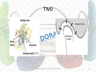 TMJ
DR.TINET MARY AUGUSTINE.BDS.MDS 36
 