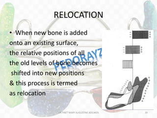 RELOCATION
• When new bone is added
onto an existing surface,
the relative positions of all
the old levels of bone becomes
shifted into new positions
& this process is termed
as relocation
DR.TINET MARY AUGUSTINE.BDS.MDS 39
 