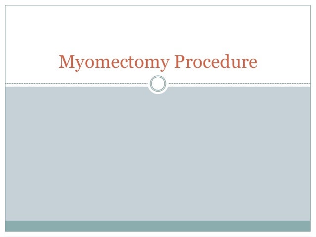 Myomectomy Procedure
 